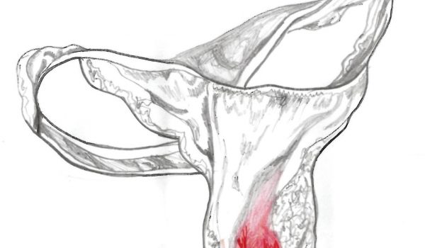 Common Objections to Axing the Tampon Tax — And What You Can Say in Response